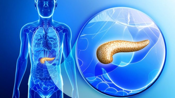 Pancreatic Cancer Screening in Development Pancreatic Cancer Screening in Development