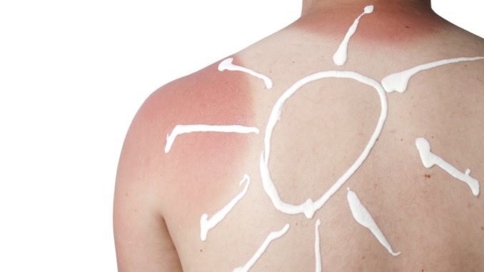 melanoma-risks-and-free-screening melanoma-risks-and-free-screening