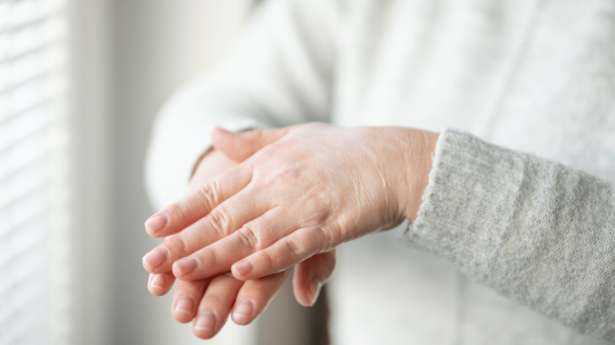 Combating Dry, Itchy Skin and Rashes