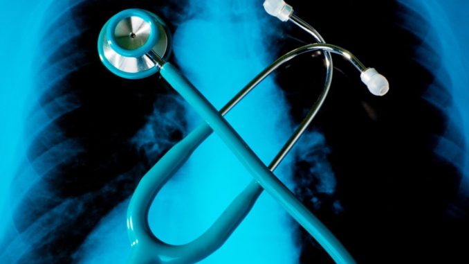New FDA treatment Option for Lung Cancer Patients New FDA treatment Option for Lung Cancer Patients