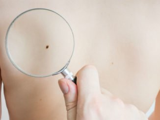 FDA Approves New Melanoma Treatment