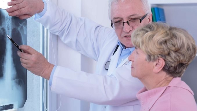 Lung Cancer Diagnosis Treatment and Resources
