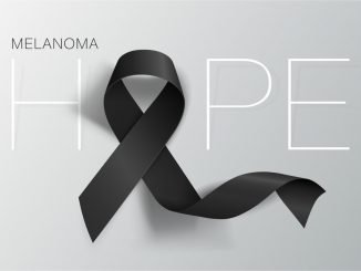 Melanoma Diagnosis Treatment and Support