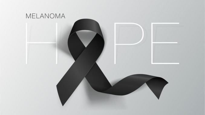 Melanoma Diagnosis Treatment and Support